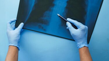 Αγώνας για να στελεχωθεί το Ακτινολογικό του Βενιζελείου – Στα όριά τους εργαζόμενοι