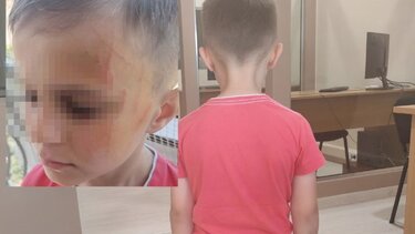 mathitis-nipiagogeio