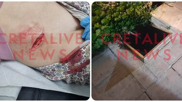 Οδός Εφόδου, Ατύχημα, Παιδάκι