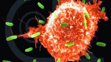 Καρκίνος του μαστού: Τα νούμερα δεν αστειεύονται- 1 στις 8 γυναίκες στην Ελλάδα θα νοσήσει