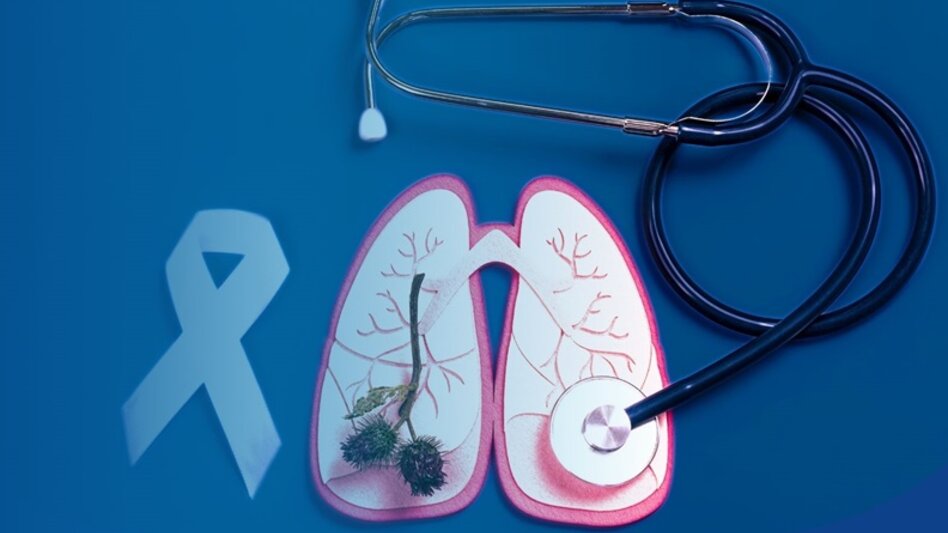 Η κρυφή "πηγή" ενέργειας των καρκινικών κυττάρων