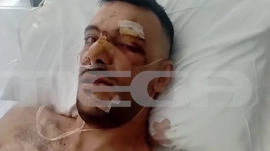 Από θαύμα ζει ο 35χρονος μετά τις 18 μαχαιριές - "Έχει τρύπες σε πνεύμονα, διάφραγμα και του κόπηκαν οι μύες"