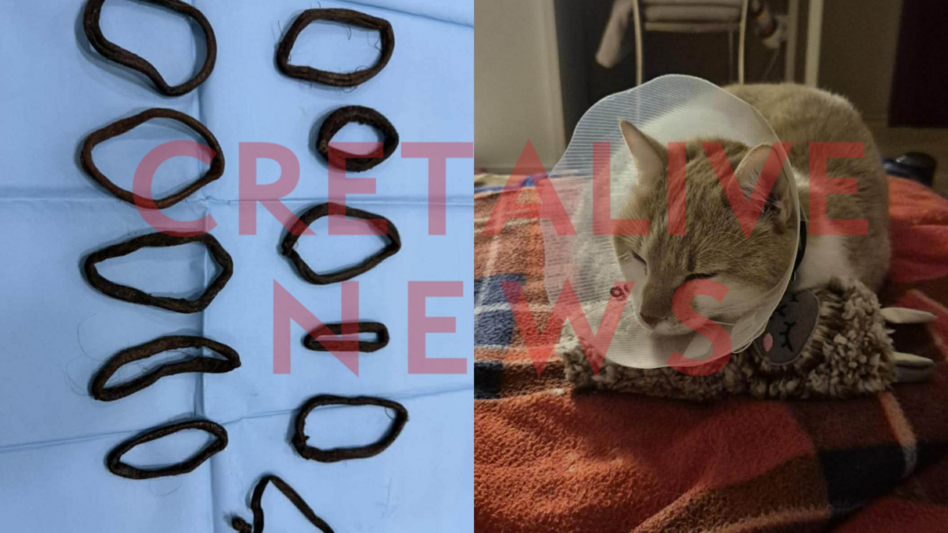 Ηράκλειο: αφαίρεσαν από την κοιλιά της 11 κοτσιδάκια για τα μαλλιά