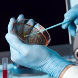 Μεταπνευμονοϊός HMPV: Πόσο σοβαρή είναι η κατάσταση – Τι λένε ΠΟΥ, ECDC