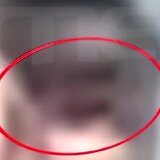 Αστυνομικός Βουλής: Φωτογραφίες με τον 14χρονο γιο του να έχει μαυρισμένο μάτι και μώλωπες στα πλευρά