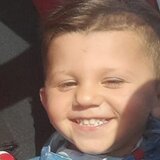 3χρονος Άγγελος: συμπίεση και μετατόπιση ζωτικών δομών του εγκεφάλου στο άτυχο αγόρι 