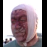 Άνδρας που επιβίωσε από την επίθεση της Χαμάς την 7η Οκτωβρίου 2023, έζησε και το μακελειό στην Αυστραλία