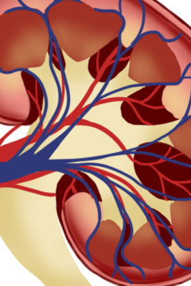 Πέτρα στα νεφρά: Συμβουλές που μειώνουν τον κίνδυνο να αναπτυχθεί