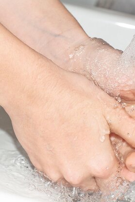 Χέρια και υγεία: Τα σημάδια που μπορεί να αποκαλύπτουν υποκείμενη πάθηση