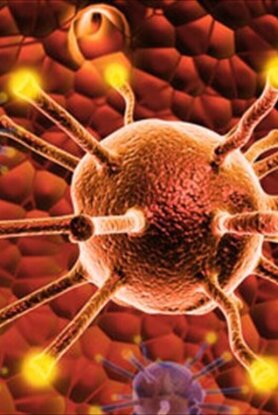 ΕΟΠΕ: Η αντιμετώπιση του καρκίνου απαιτεί ολιστική προσέγγιση