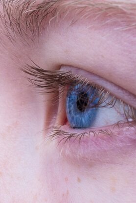 Γλαύκωμα: Η «σιωπηλή» επιδημία που απειλεί εκατομμύρια ανθρώπους με απώλεια όρασης