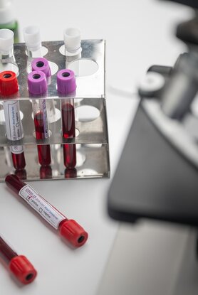 Απλή εξέταση αίματος μπορεί να προβλέψει τη νόσο του Crohn χρόνια πριν από την εμφάνιση των συμπτωμάτων