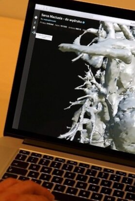 Η εξάπλωση της καρδιακής ανεπάρκειας έχει πάρει τη μορφή πανδημίας